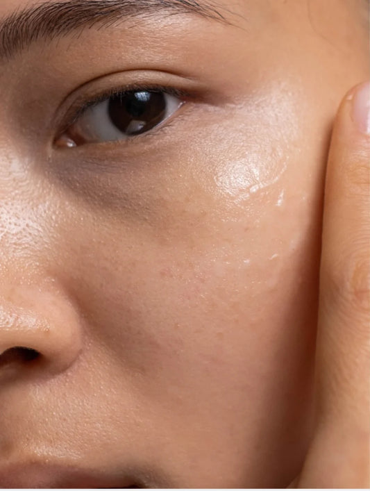 NIACINAMIDE GEL